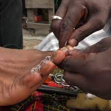 Street Nail-Cutting Practices in The Gambia: A Public Health Concern