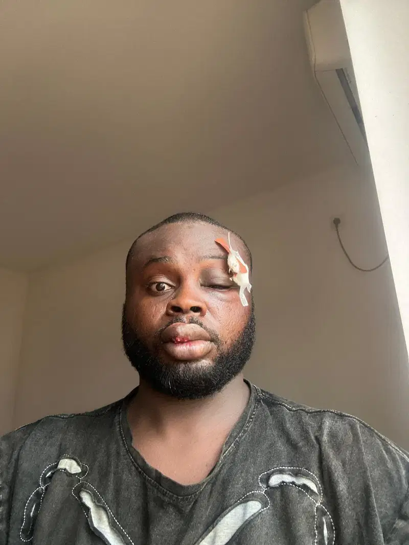 Nigeria: Family of Nigerian engineer pleads gov’t help after mysterious death in Myanmar