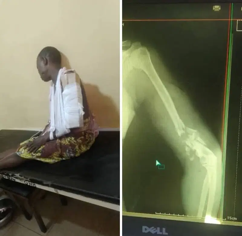 Nigeria: Immigration Officer allegedly shoots woman in Badagry community