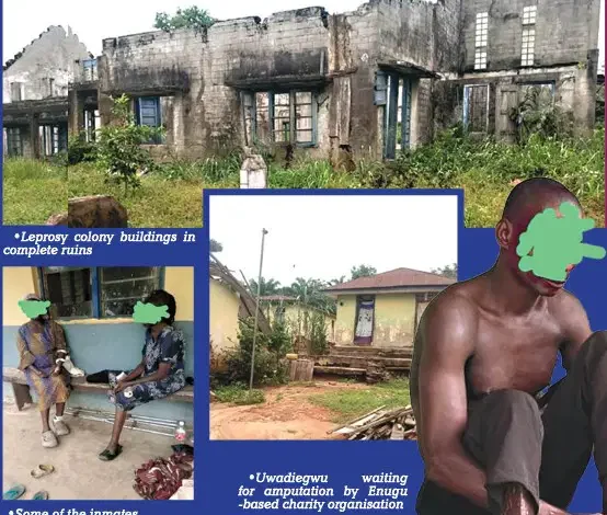Nigeria: Neglected and forgotten: Plight of Uzuakoli leprosy colony inmates